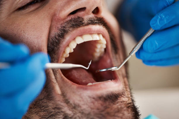 Best Emergency Gum Treatment in Greenville, MS